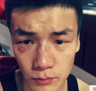 杨兴新TKO日本拳王获双洲际头衔 拜山坡完美卫冕