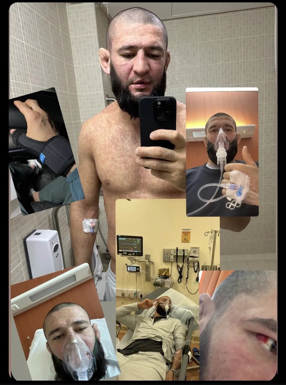 俄罗斯不败新星坎扎特·奇马耶夫透露自己病情严