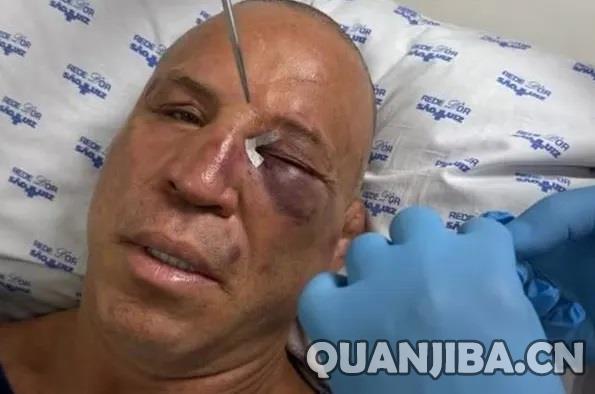 UFC资深选手万德雷·席尔瓦赛后爆发冲突，遭遇重击昏迷不醒